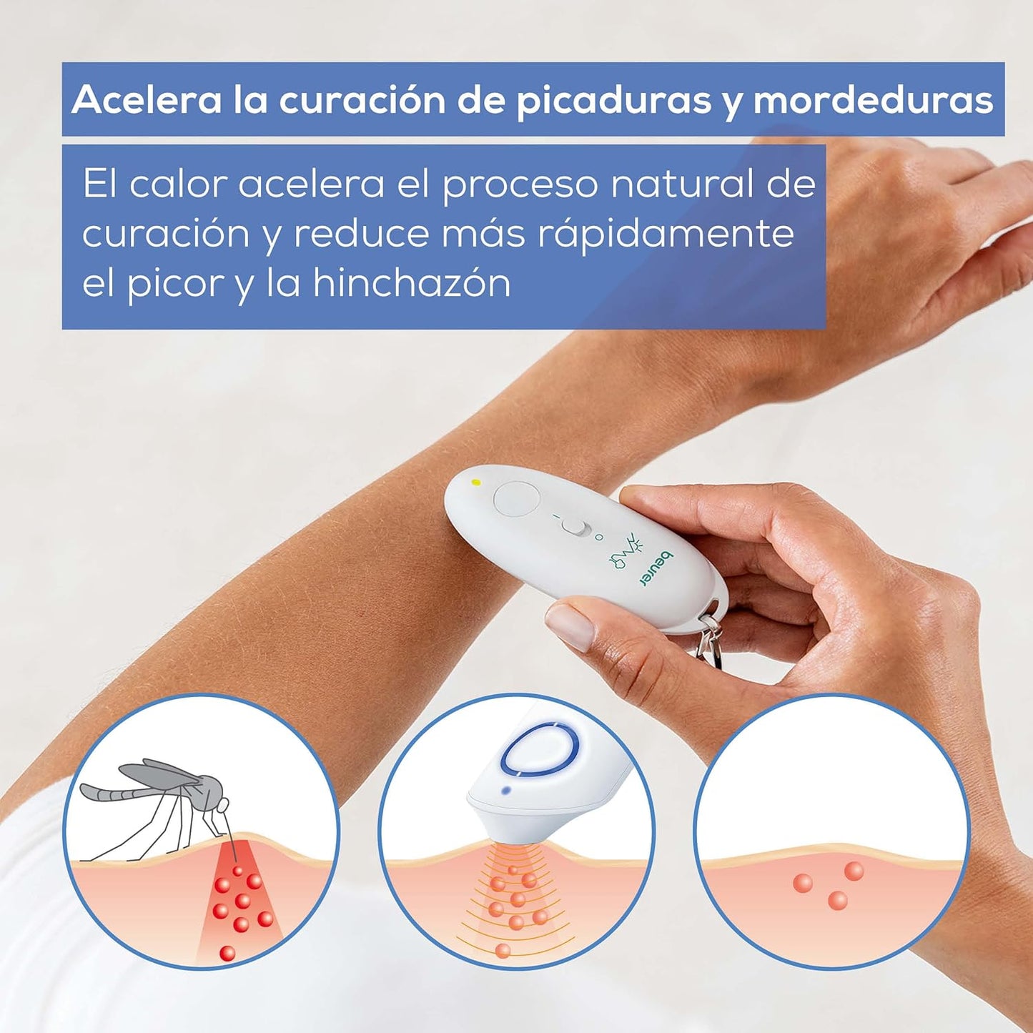 Beurer BR 10 Aparato contra picaduras de insectos, para el tratamiento de mordeduras y picaduras de insectos